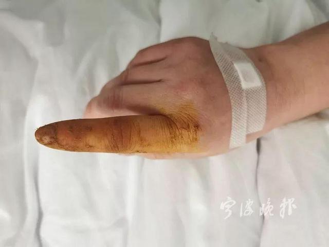 #中国青年网#小心！冬天这种动物最喜欢往你晒着的被子衣服里钻！2月大宝宝中招被送进医院