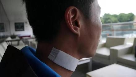 【上观新闻】凶残至极！受伤港警：暴徒每次行动都要置警察于死地