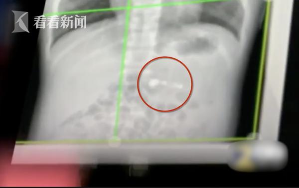 「上游新闻」夜读 | 男孩误吞AirPod 医生建议自行排出 | 美女网友撩到9个“老公”