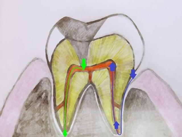 乳牙根管分布图图片