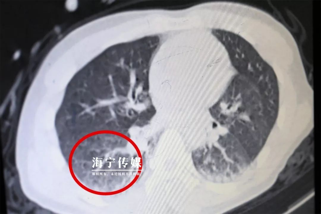 青春湖北@悲痛！湖北2名男子因喝酒身亡！近期高发，一定要注意了