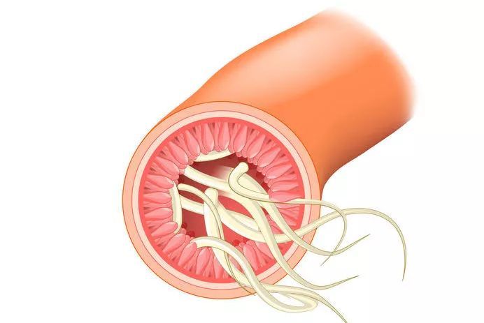 「新闻坊」惊！9岁男孩屁股又疼又痒，医生一看：10多条虫子从肛门爬出！