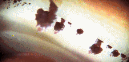 文汇报■这部BBC纪录片告诉你，新型冠状病毒是如何入侵的