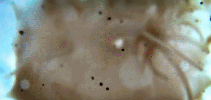 文汇报■这部BBC纪录片告诉你，新型冠状病毒是如何入侵的