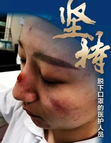 文汇报@中国医生，是什么让你们不放弃？