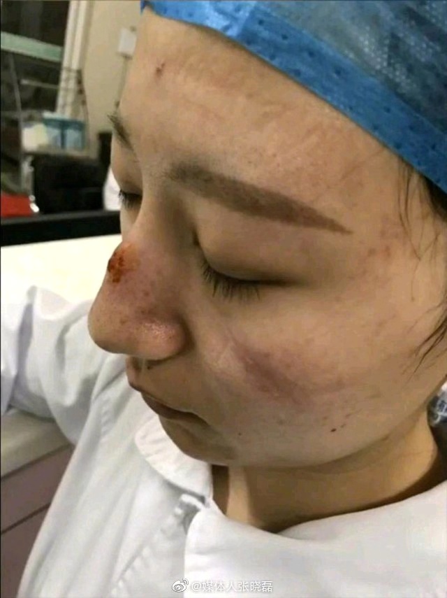 文汇报：手绘丨医生脸上依稀可见的伤痕，也是她们美丽的勋章