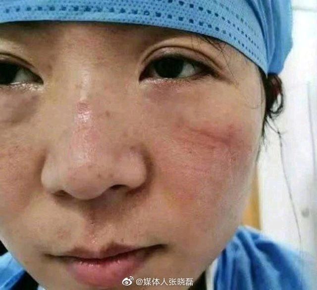 文汇报：手绘丨医生脸上依稀可见的伤痕，也是她们美丽的勋章