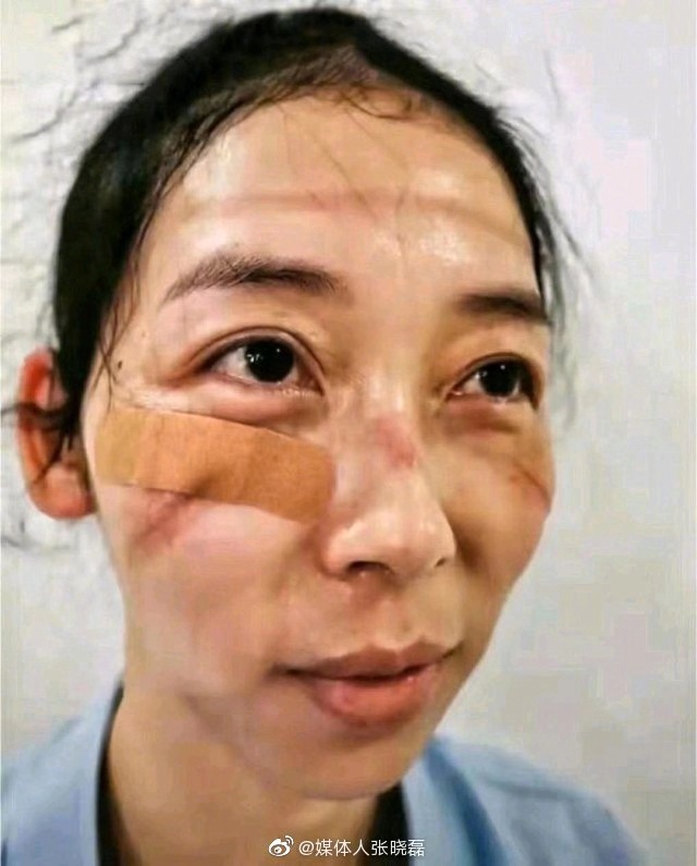 文汇报：手绘丨医生脸上依稀可见的伤痕，也是她们美丽的勋章
