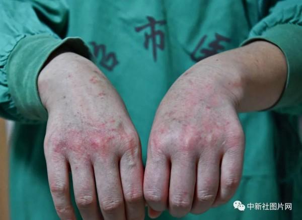 「新民网」今天，向所有医务人员致敬