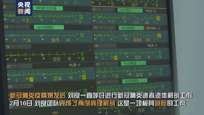 #肺炎#首例新冠肺炎尸检报告发布：气道大量黏稠分泌物