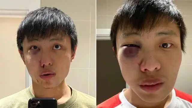 「国际社会」这个案子令世卫总干事震惊，英国警方已公布嫌犯照片