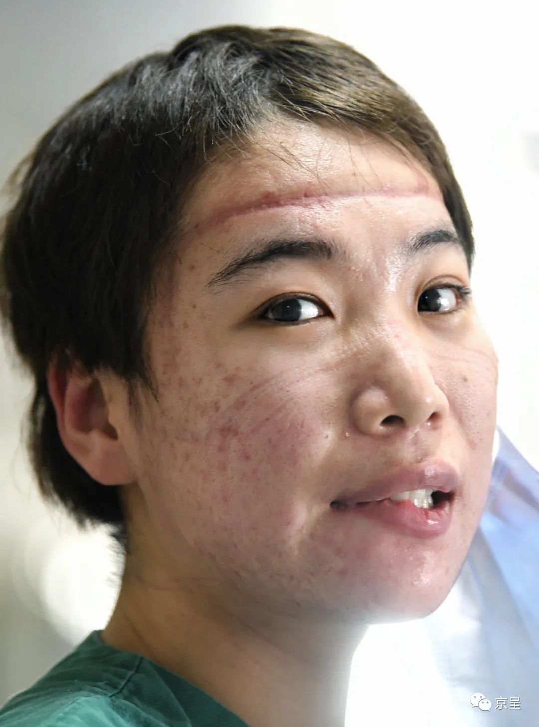 『中国节日』伤痕也是美!致敬!援鄂北京医疗队女英雄