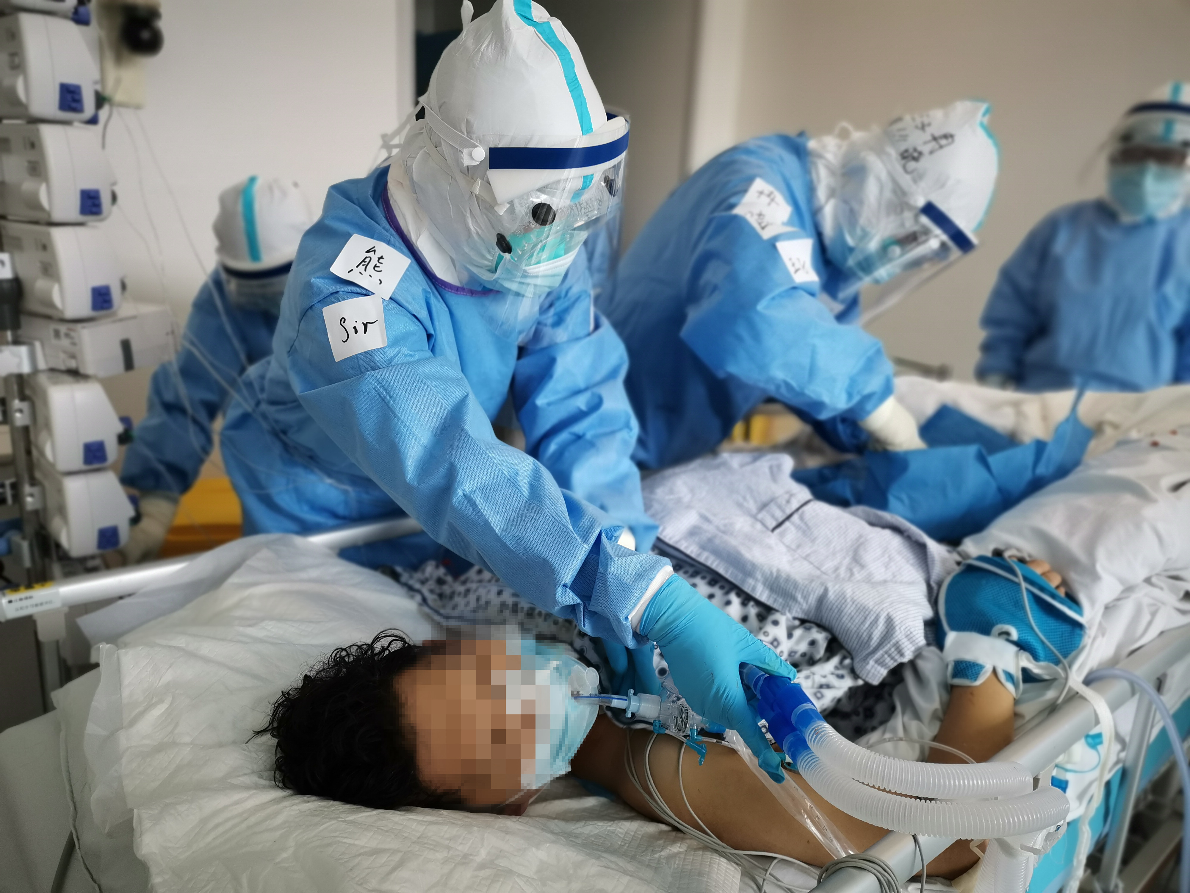 生死线徘徊一个月新冠肺炎重症患者成功脱离ecmo