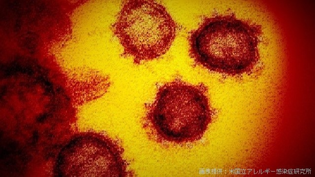 #国际#日本国内新冠肺炎新增102例确诊,单日新增首次破百