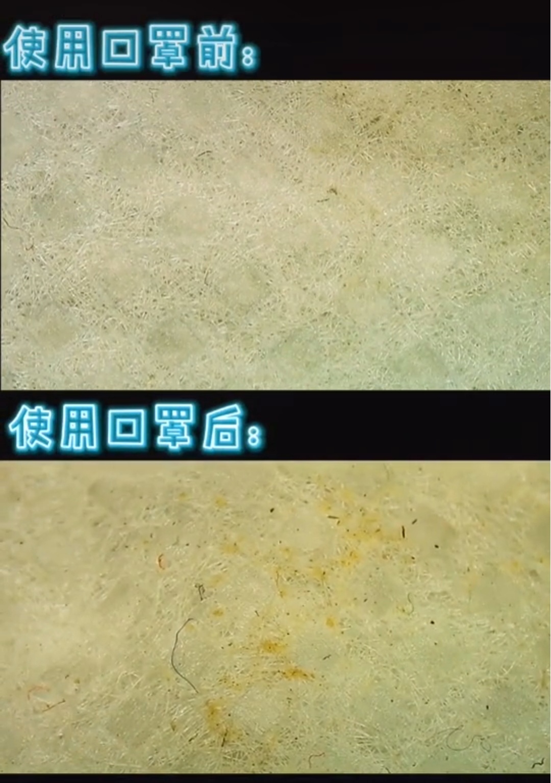 口罩@把使用过的口罩放大1000倍，才发现…