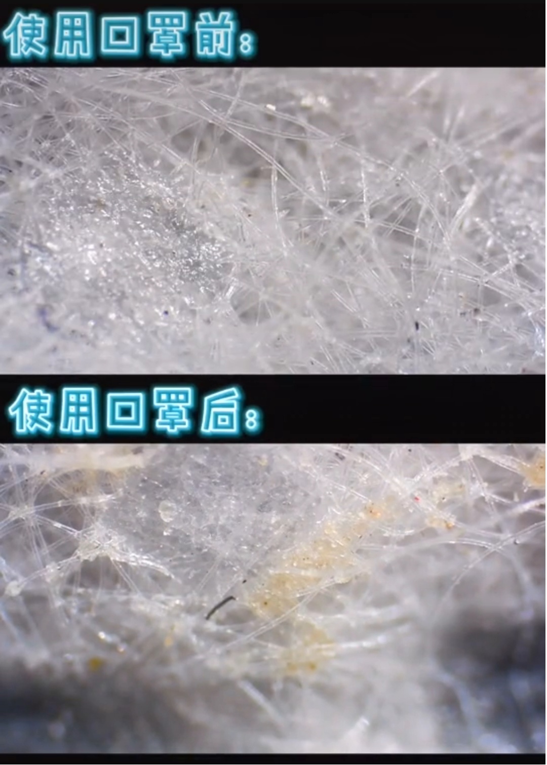 口罩@把使用过的口罩放大1000倍，才发现…