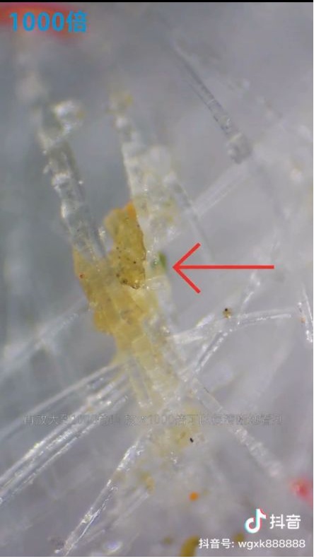 口罩@把使用过的口罩放大1000倍，才发现…