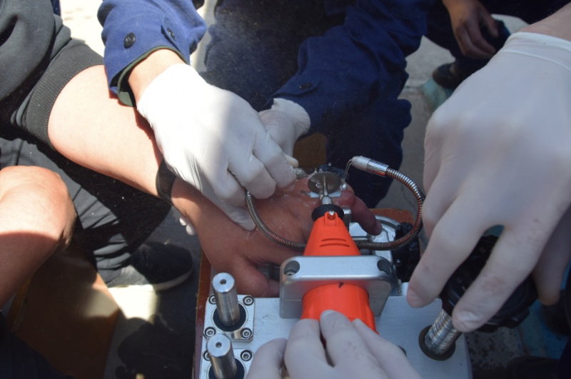 「婚戒」婚戒戴上就未曾取下,男子手指肿胀求助消防员