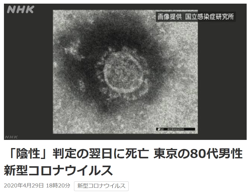 #国际#日本出现新冠特殊病例：前一天测试呈阴性，次日病情急剧恶化死亡