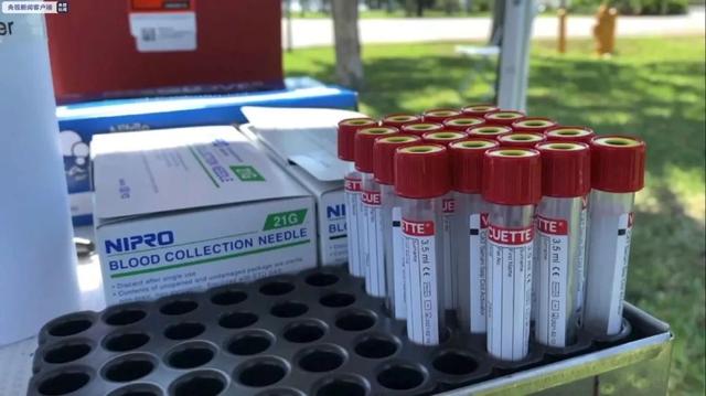 国际什么情况?美国新冠抗体携带者1月底就出现症状了