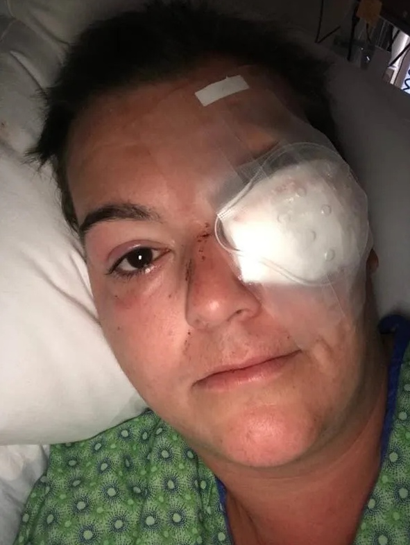 国际|永久失明、被暴打...记者：警察瞄准了我