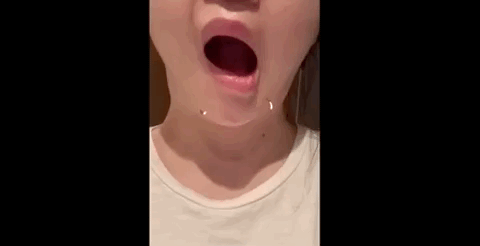视觉志|?那些被「假整容」毁掉的年轻女孩们。