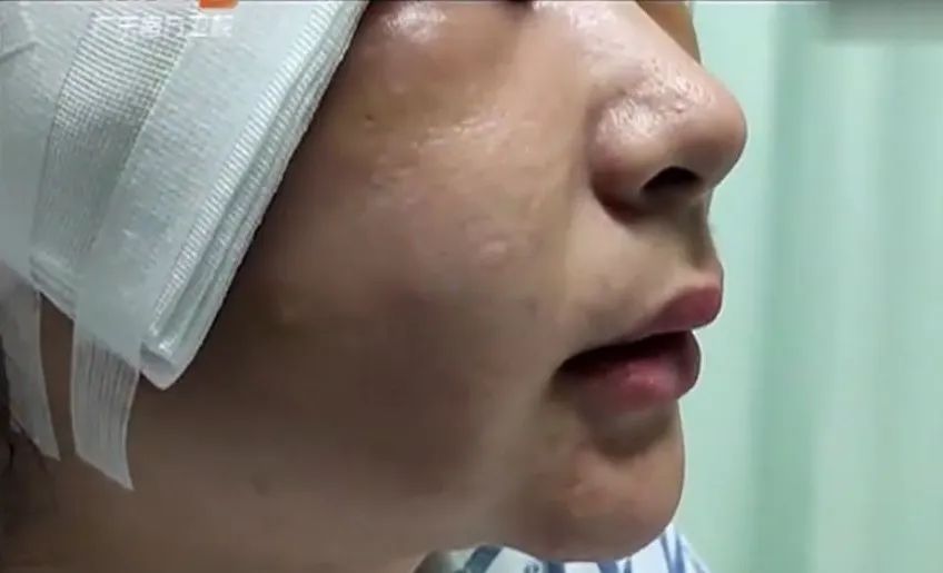 视觉志|?那些被「假整容」毁掉的年轻女孩们。