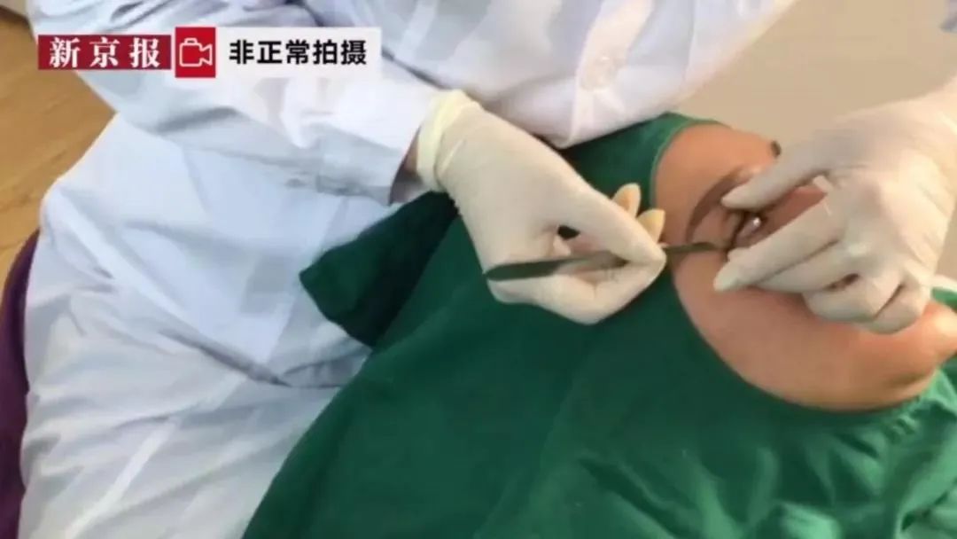 视觉志|?那些被「假整容」毁掉的年轻女孩们。