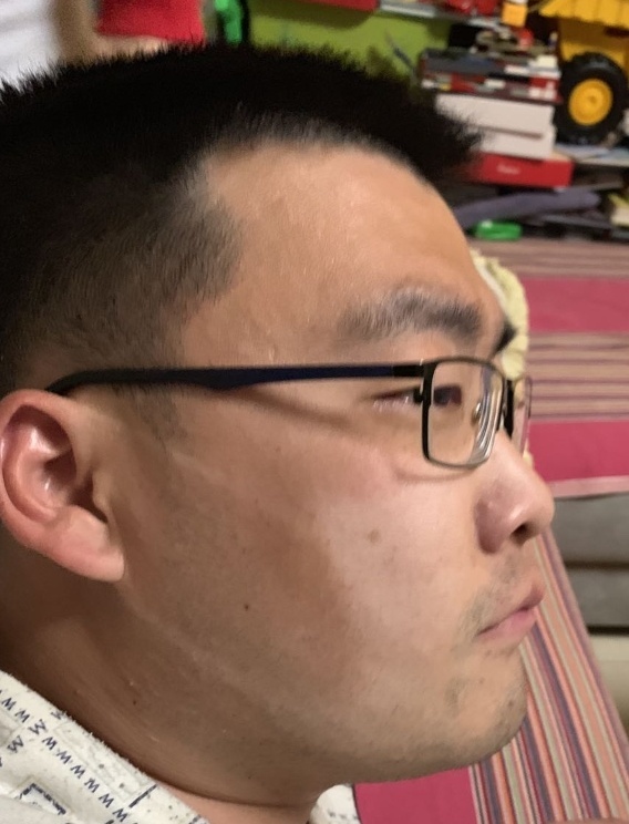 口罩|“口罩脸”“小黑手”“手表印”……这是最美战疫“勋章”