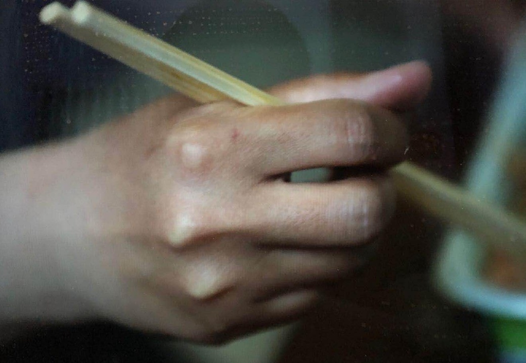口罩|“口罩脸”“小黑手”“手表印”……这是最美战疫“勋章”