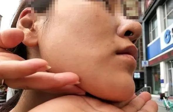 视觉志|当代社会里「审美畸形」现状。