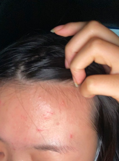 社会|险!精装房浴室玻璃门炸裂,19岁女孩身上多处被扎伤