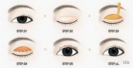 单眼皮|说出来你可能不信，wink能让眼睛变大