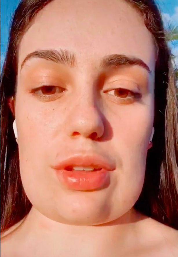 抽脂手术|澳大利亚19岁少女做下巴抽脂手术 拆线后新脸吓坏家人(图)