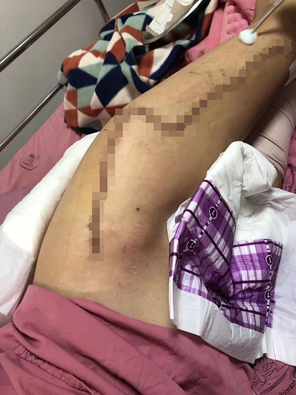 王灵|泰国坠崖孕妇：从地狱回来的人