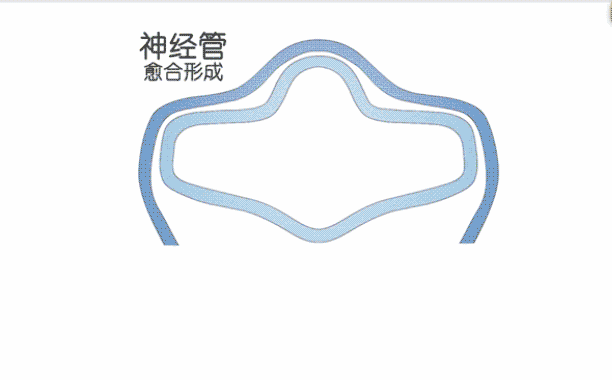 视网膜|有没有想过，我们的眼睛是不完美的？