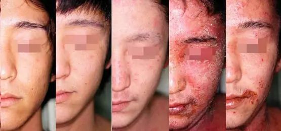 兴奋剂|健身送命贴，了解一下？