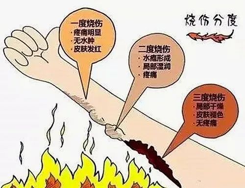 核导弹|当核弹落在一个400万人口的城市里，会发生什么？