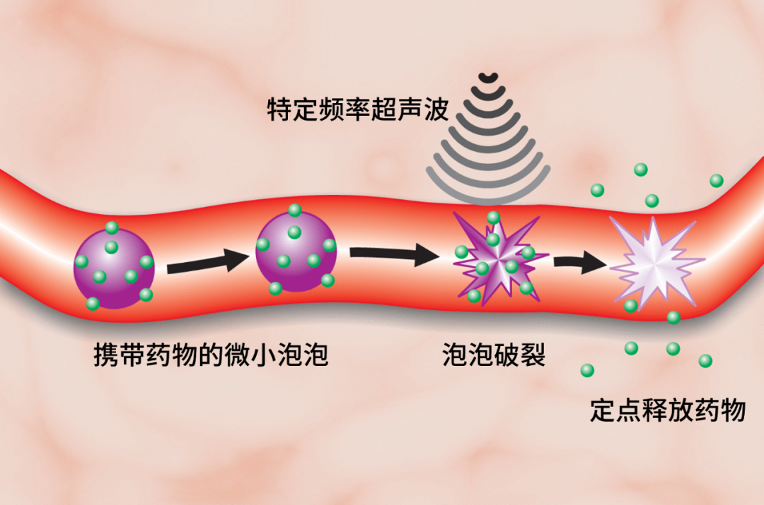 科学|“啪！没了” 小朋友哭了，泡泡科学家却玩出了花