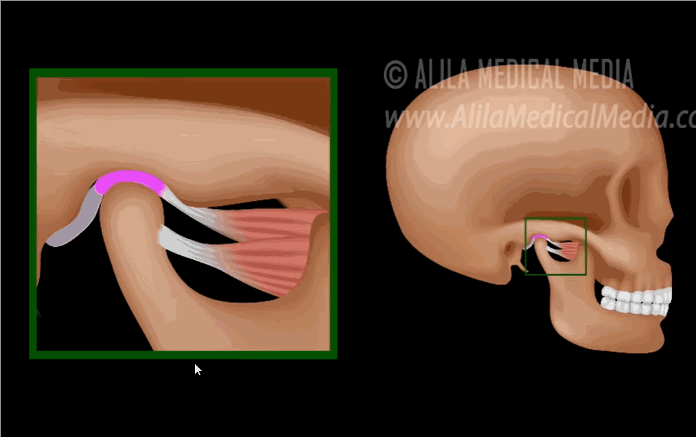 关节弹响|打哈欠的时候,嘴千万别张太大