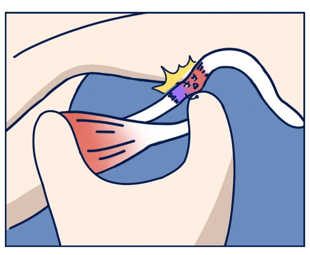 关节弹响|打哈欠的时候,嘴千万别张太大