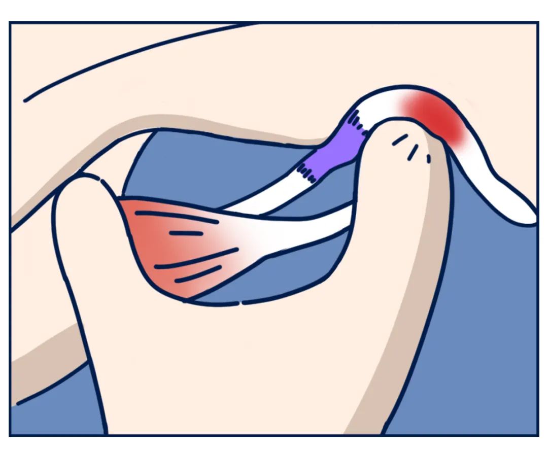 关节弹响|打哈欠的时候,嘴千万别张太大