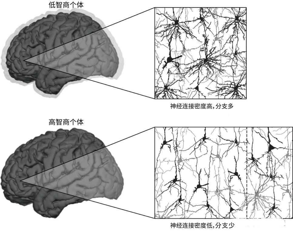 大脑结构|聪明的人，大脑结构会不一样吗？