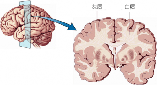 举个例子 你们实现脑-机之间的连接应该不需要做开颅质醢