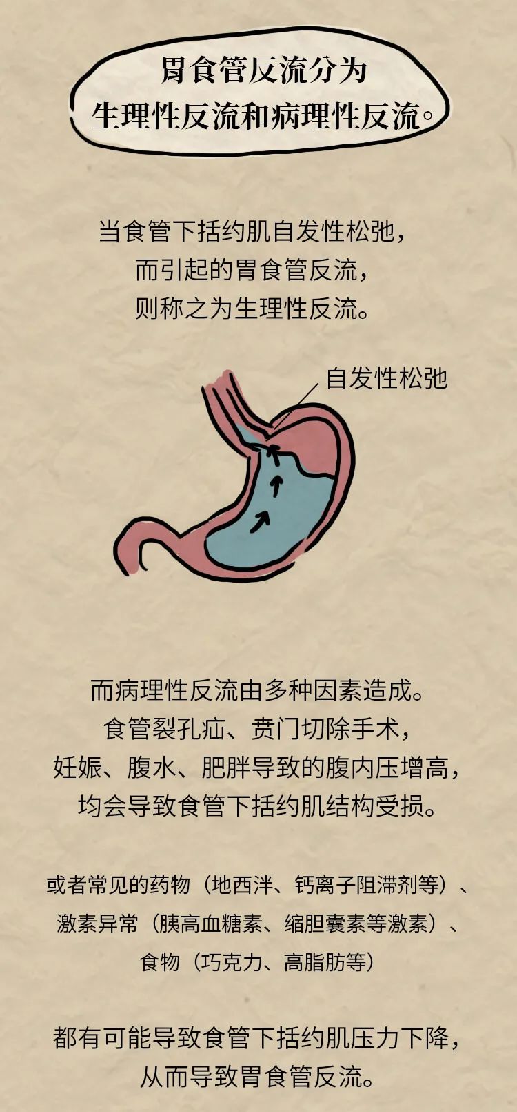 胃食管反流你必须知道的这几件事，一图读懂！