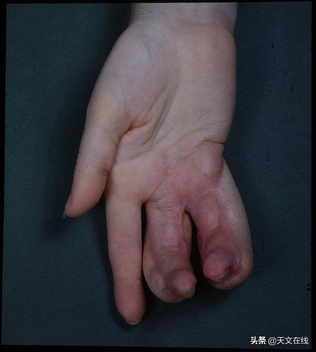 |当你掉进粒子加速器里时,那会发生什么?答案不敢想象