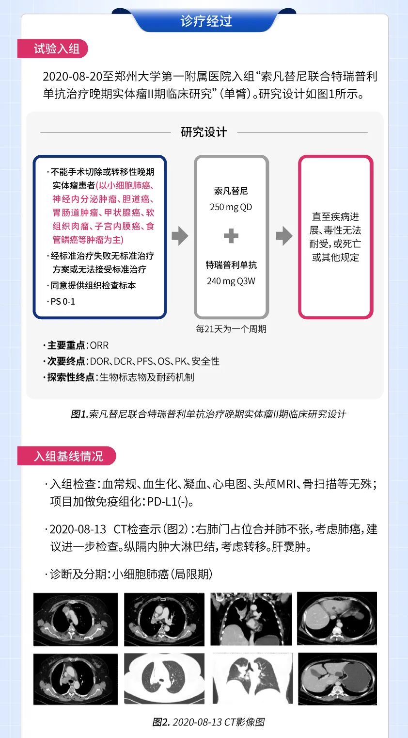 肺凡例量索凡替尼联合免疫二线治疗复发小细胞肺癌病例解析