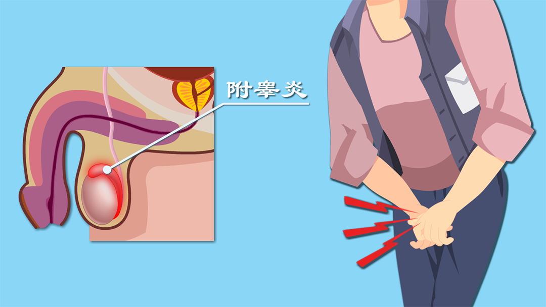 附睾炎会伤蛋蛋搞出不育科普附睾炎和蛋蛋的秘密