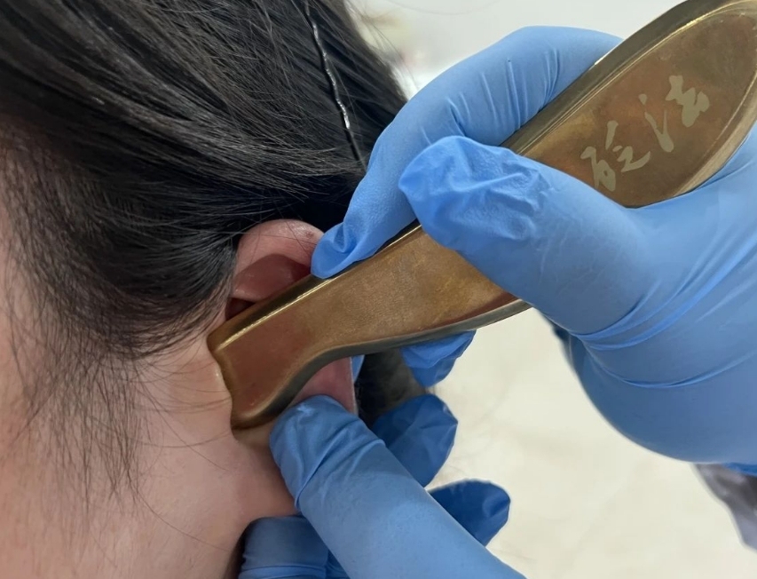 2,耳部全息刮痧