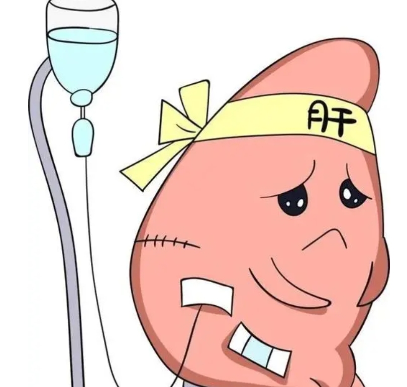 女子肝脏肿瘤大如拳头肝癌来时静悄悄这样做远离它